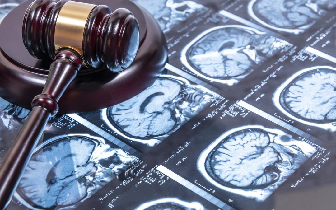 Brain Injury Lawsuits