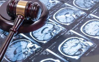 Brain Injury Lawsuits